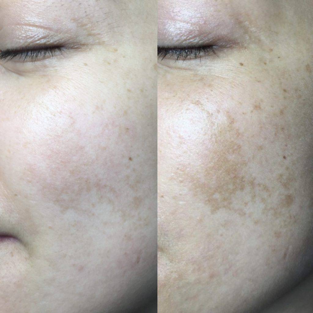 skin results 1