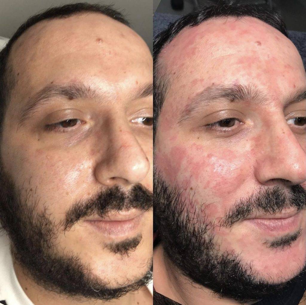 skin results 16