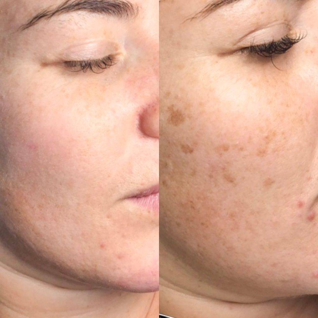 skin results 5